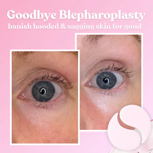 Instant Lift PDRN Collagen Eye Patches